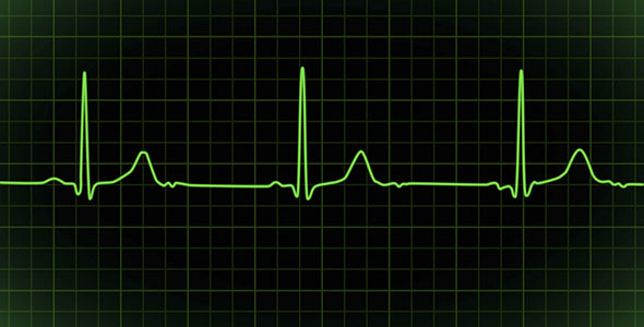 VideoHive Heartbeat Monitor EKG Cardiogram Loopable 2904647 VideoHive Heartbeat Monitor EKG Cardiogram Loopable 2904647