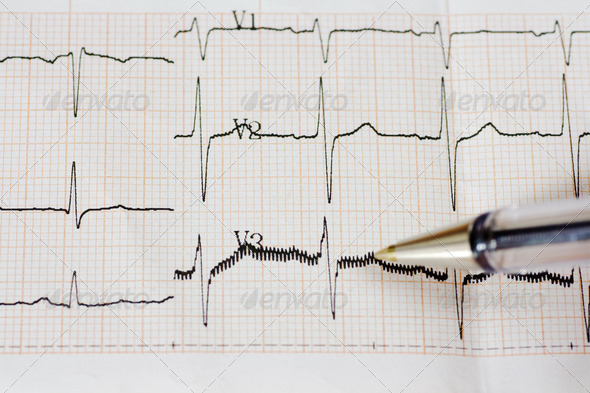 Arrhythmia (Misc) Photo Download